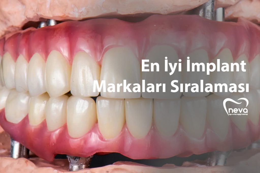 En İyi İmplant Markaları Sıralaması